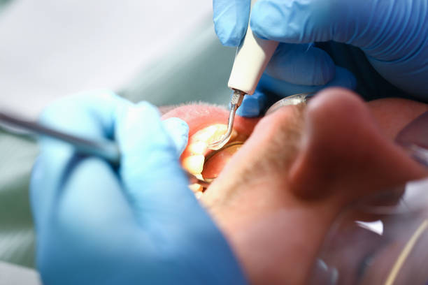 Best Pediatric Emergency Dentist in Somerset, OH