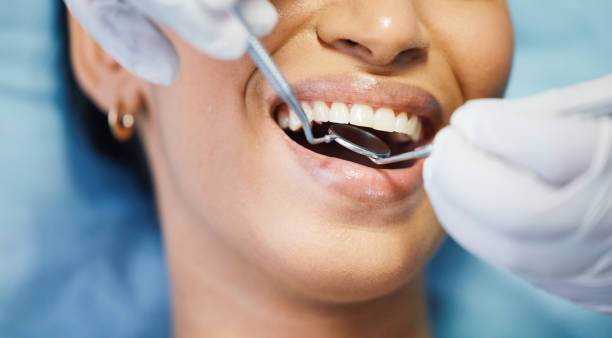 Best Walk-In Emergency Dentist in Somerset, OH